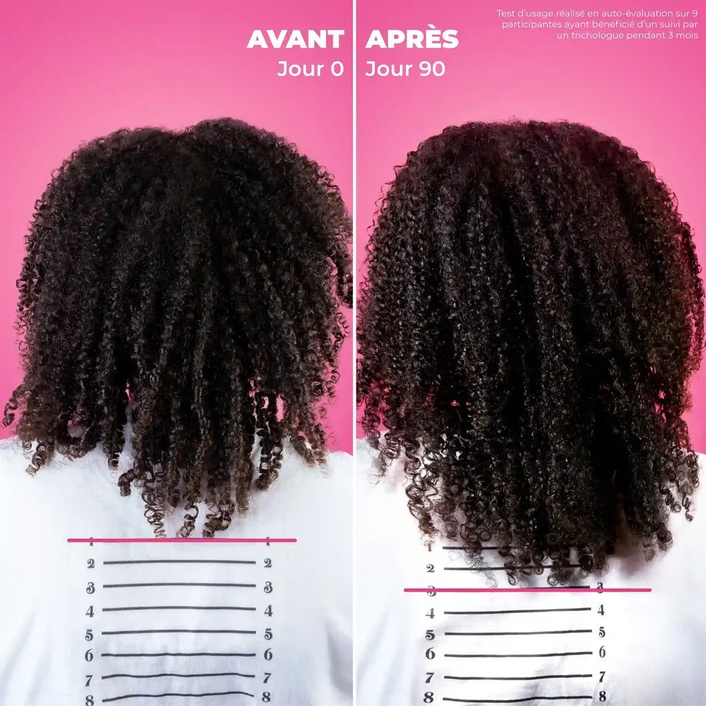 Sérum Cuir Chevelu Anti-Chute – Les Secrets de Loly (Kurl Hero) – soin capillaire naturel pour cheveux ondulés, bouclés, frisés et crépus | L’Art des Boucles Suisse